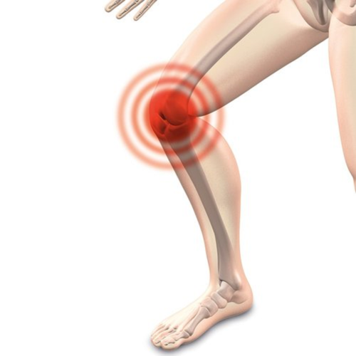 Arthrocalman 2384253 1280